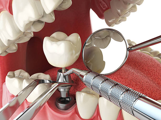Best Emergency Denture Repair in Pembroke, VA